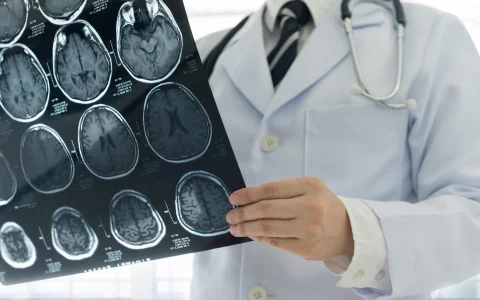 Doctor check up x-ray film of the brain by mri or ct scan brain at patient room hospital. medical concept.